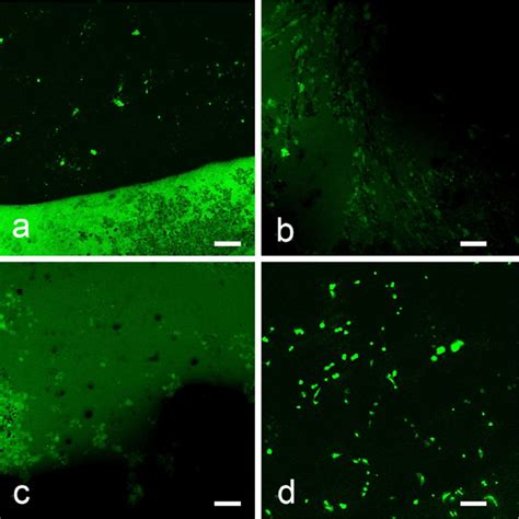 Confocal Micrographs Of DCFDA Assay For ROS Detection A Normal