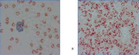 Figure 3 From Comparison Of Two Methods For The Diagnosis Of Chronic