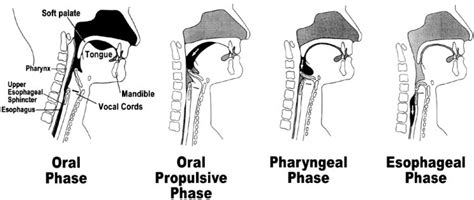 Phases Of Dysphagia – Stages Of Dysphagia – CLXRAU