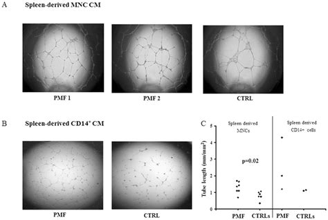 In Vitro Tubulogenesis Induced By Spleen Mnc Or Selected Cd14 Cell Download Scientific Diagram