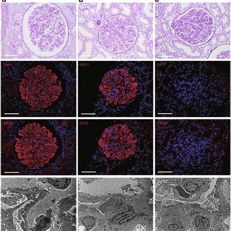 Light Microscopy Immunofluorescence And Electron Microscopy Of