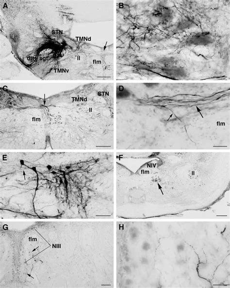 Labeled Structures After Bda Injections Into The Sensory Trigeminal