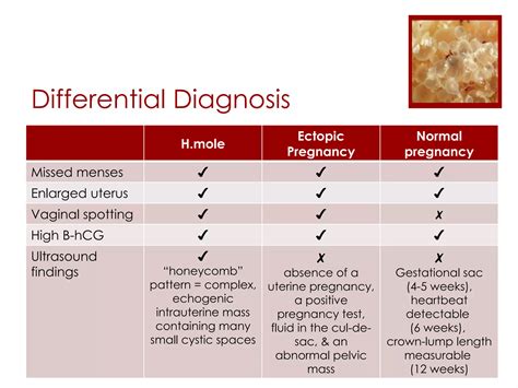 Differential Diagnosis Of Ectopic Pregnancy 11