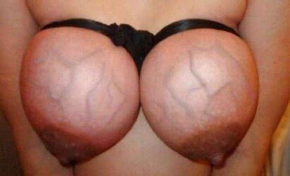 Restrain Bondage Titten ZB Porn