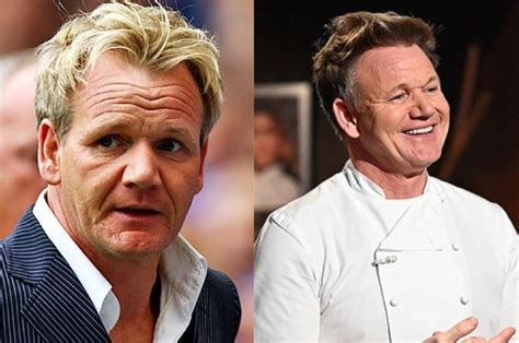 Gordon Ramsay Hair Transplant Everything You Need To Know