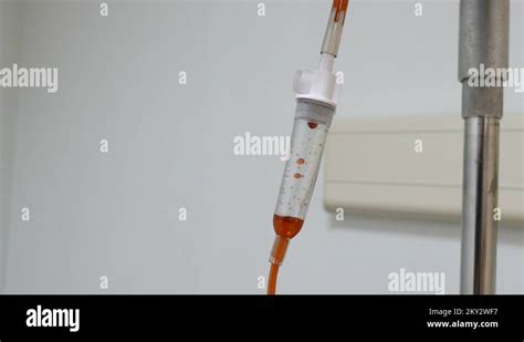 Closeup Of Chemotherapy IV Drip For Cancer Treatment Stock Video