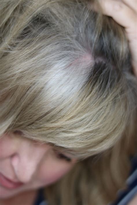 My Transition to Gray Hair - dimplesonmywhat