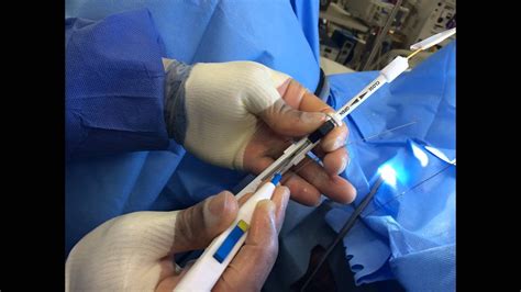 ureteroscopic basket fulguration  youtube