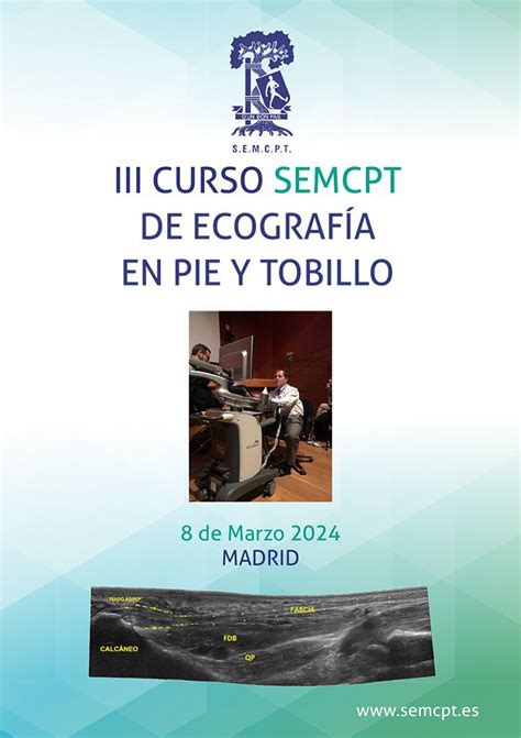 III Curso SEMCPT de ecografía en pie y tobillo SEMCPT