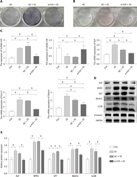 Exercise Promotes Osteogenic Differentiation By Activating The Long Non