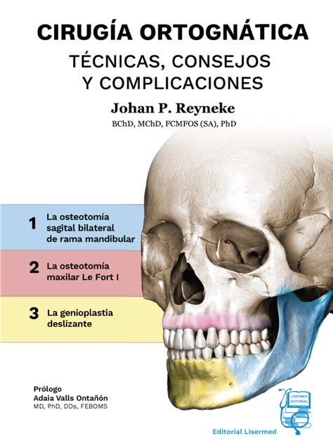 Cirugía Ortognática Técnicas consejos y complicaciones Johan P