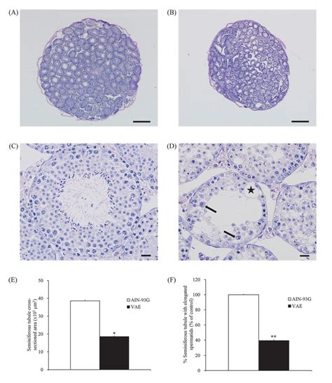 Photographs Of He Stained Testicular Cross Sections From Control And