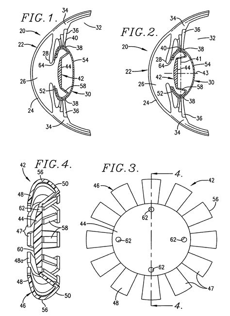 Intraocular Lens Implant patented technology retrieval search results - Eureka | Patsnap