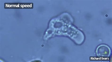 Under The Microscope Naegleria Fowleri Colloquially Known As A Brain Eating Amoeba 021923