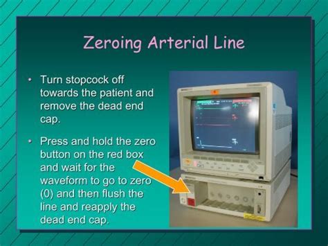 Zeroing Arterial Line