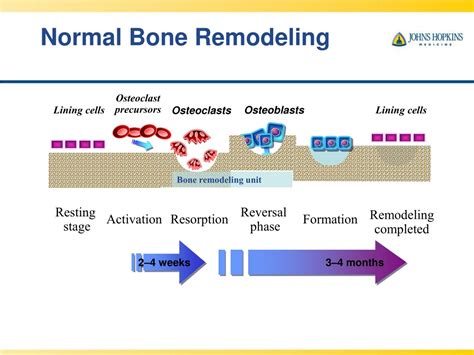 PPT - Maintaining Skeletal Health for the Transplant Recipient ...