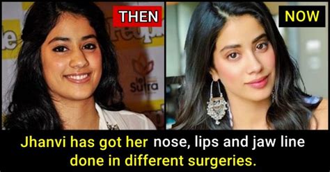 Jhanvi Kapoor Will Be Very Upset After Sonam Kapoors Take On Plastic