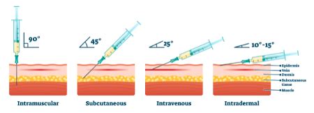 Med Procedures Injections Flashcards Quizlet