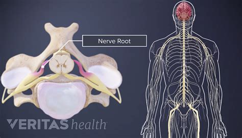 Spinal Cord and Spinal Nerve Roots