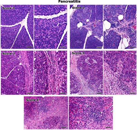 Histopathological Grading Of Pancreatitis Lesions In Cats Score 0