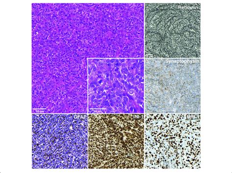 Histology And Immunohistochemistry Hematoxylin Eosin Stained Image