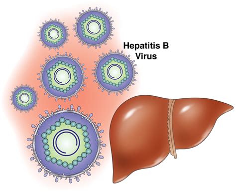 Hepatitis B Symptoms Treatment Causes What Is Hepatitis B Std