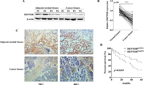 Figure 1 From Deptor Suppresses The Progression Of Esophageal Squamous