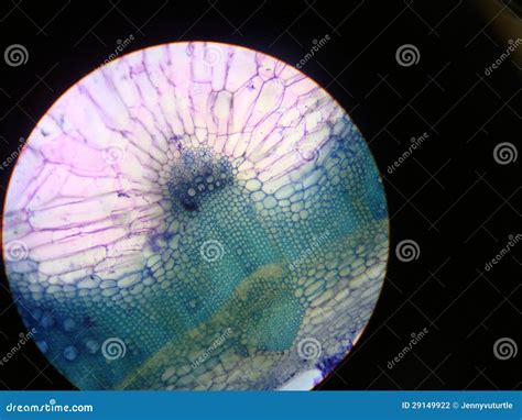 Close Up Of Cell Culture Samples On LB Agar Medium In Petri Dish And