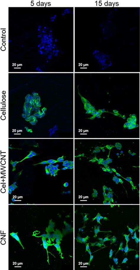 Confocal Microscopy Images Of Sh Sy Y Cells On Different Scaffolds And