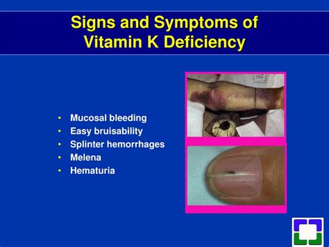 What Causes Vitamin K Deficiency In Dogs