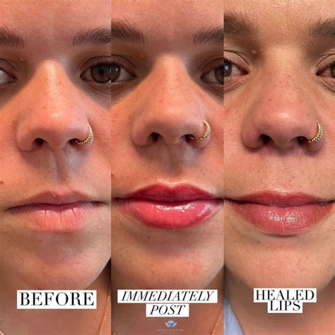 Premier Lip Blush Services In Orlando Fl