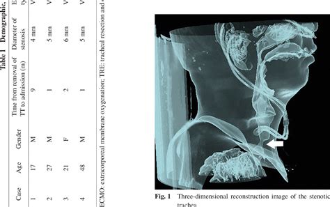 Figure 1 From Tracheal Reconstruction Surgery Supported By