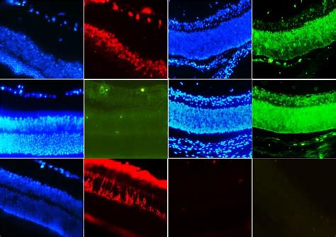 Immunohistochemistry On Normal Mouse Retina For Pax Ki And Pkc