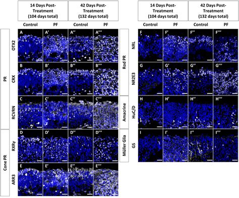 Notch Inhibition At D Causes Mass Generation Of Immature Rod