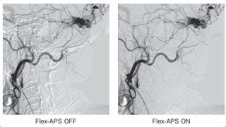 Minimally Invasive Experience 岛津医疗