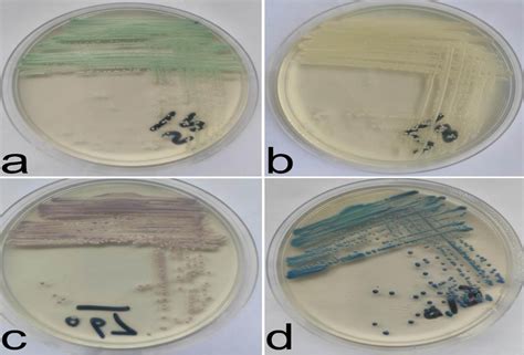 Color Of Different Species On Chromogenic Agar Download Scientific Diagram