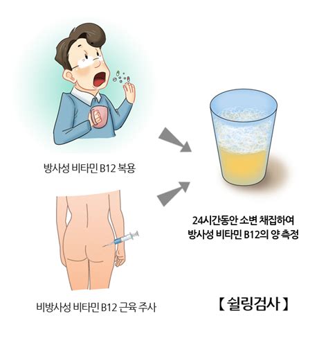 쉴링검사 검사시술수술 정보 의료정보 건강정보 서울아산병원