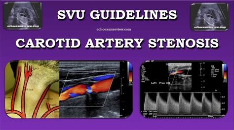 Vascular Ultrasound | Vascular ultrasound, Medical ultrasound, Ultrasound