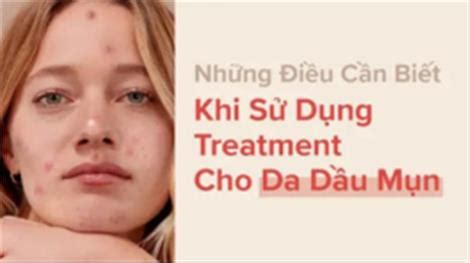 Những điều cần biết khi sử dụng treatment cho da dầu mụn