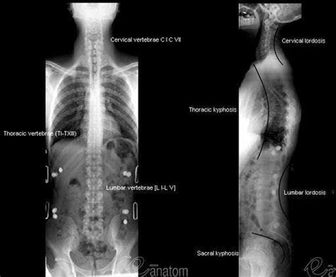 Anatom A Columna Vertebral Umls C Vista Anteroposterior