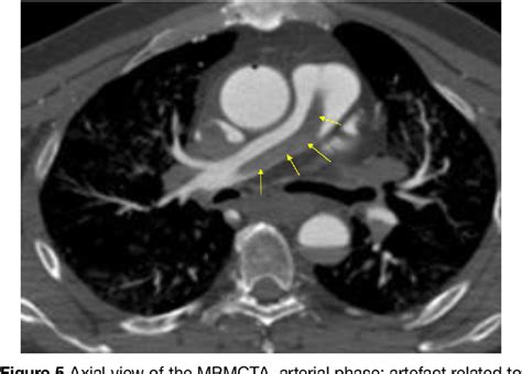 Figure 1 From The Lausanne Forensic Pathology Approach To Post Mortem