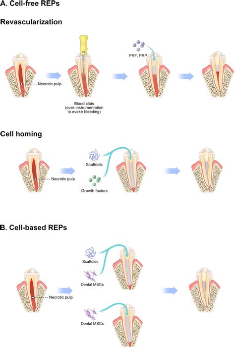 Frontiers Roles Of Dental Mesenchymal Stem Cells In The Management Of