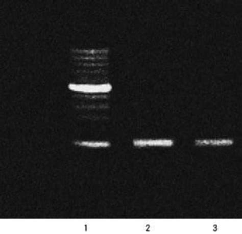 High Pure Pcr Template Preparation Kit Sigma Aldrich