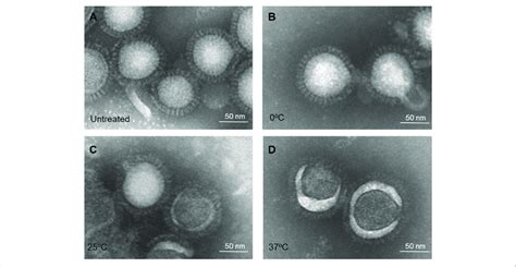 | Electron microscopy of influenza inactivated whole virus antigen ...