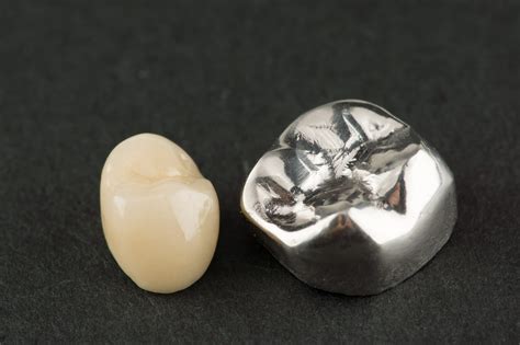 Repairing A Dental Crown