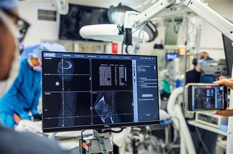 Uae 100 Successful Robot Assisted Surgeries This Year