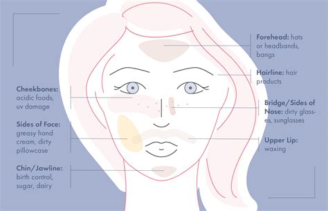 Face Mapping For Acne—recurring Breakouts In The Same Place