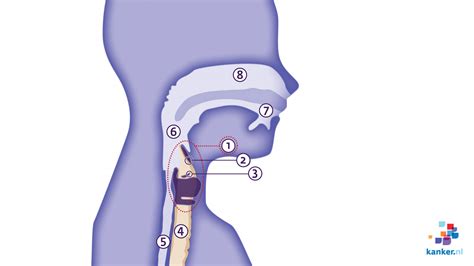 Informatie Over Het Strottenhoofd Kankernl