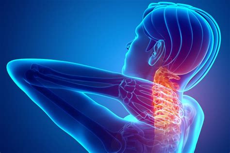 پزشکی ابن سیناCervical Spinal Canal Stenosis Surgery - پزشکی ابن سینا