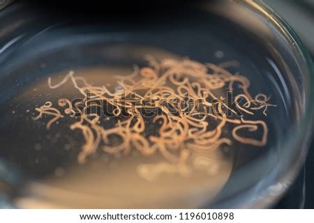 Free Lumbricoides Stock Photos Stockvault Net